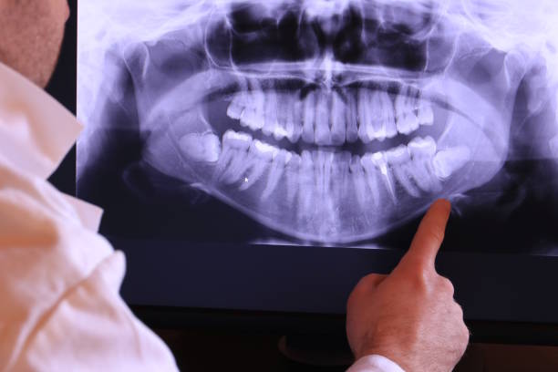 Best Emergency Dental Care for Broken or Chipped Teeth in Buffalo, NY